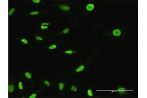 Immunofluorescence of purified MaxPab antibody to XPO5 on HeLa cell. (XPO5 抗体  (AA 1-1204))