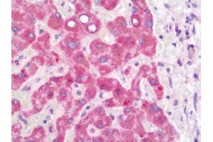 Immunohistochemistry (IHC) image for anti-Hydroxyacyl-CoA Dehydrogenase/3-Ketoacyl-CoA Thiolase/enoyl-CoA Hydratase (Trifunctional Protein), beta Subunit (HADHB) antibody (FITC) (ABIN1957015)