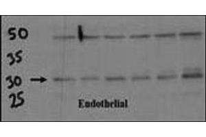 Endothelial cell lysate transferred to membrane was incubated with DSCR1 antibody at a 1:500 dilution. (RCAN1 抗体  (AA 222-252))