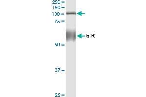Immunoprecipitation of TUBGCP2 transfected lysate using anti-TUBGCP2 MaxPab rabbit polyclonal antibody and Protein A Magnetic Bead , and immunoblotted with TUBGCP2 MaxPab rabbit polyclonal antibody (D01) . (TUBGCP2 抗体  (AA 1-902))