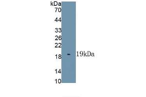 Detection of Recombinant IL1F9, Human using Polyclonal Antibody to Interleukin 1 Family, Member 9 (IL1F9) (IL1F9 抗体  (AA 1-162))