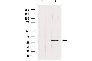 Western Blotting (WB) image for anti-OTU Domain, Ubiquitin Aldehyde Binding 2 (OTUB2) (Internal Region) antibody (ABIN6263917)