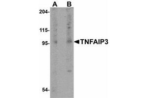 Image no. 1 for anti-Tumor Necrosis Factor, alpha-Induced Protein 3 (TNFAIP3) (Internal Region) antibody (ABIN478080) (TNFAIP3 抗体  (Internal Region))