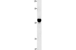 Western Blotting (WB) image for anti-Tumor Necrosis Factor Receptor Superfamily, Member 21 (TNFRSF21) antibody (ABIN2425779) (TNFRSF21 抗体)