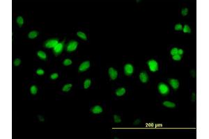 Immunofluorescence of monoclonal antibody to FBXL10 on HeLa cell. (KDM2B 抗体  (AA 457-555))