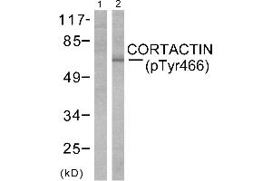 Western blot analysis of extracts from cos-7cells using Cortactin (phospho-Tyr466) antibody (Line 1 and 2). (Cortactin 抗体  (pTyr466))