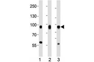 Western blot analysis of lysate from 1) HeLa, 2) PC3, and 3) HT-1080 cell line using CD44 antibody at 1:1000.