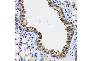 Immunohistochemistry of paraffin-embedded mouse lung using ESD antibody (ABIN5973666) at dilution of 1/100 (40x lens). (Esterase D 抗体)