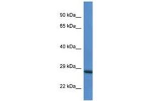 Image no. 1 for anti-RAB6C (WTH3DI) (AA 118-167) antibody (ABIN6746841) (WTH3DI 抗体  (AA 118-167))