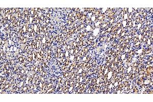 Detection of HIF1a in Rat Kidney Tissue using Polyclonal Antibody to Hypoxia Inducible Factor 1 Alpha (HIF1a) (HIF1A 抗体  (AA 216-336))