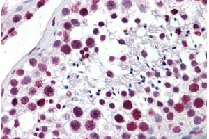 Human Testis: Formalin-Fixed, Paraffin-Embedded (FFPE) (Aryl Hydrocarbon Receptor 抗体  (AA 279-376))