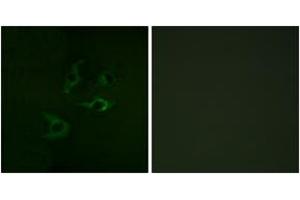 Immunofluorescence analysis of A549 cells, using CBL (Ab-774) Antibody. (CBL 抗体  (AA 740-789))