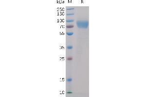 SDS-PAGE (SDS) image for Natural Killer Cell Receptor 2B4 (CD244) (AA 22-221) protein (mFc-His Tag) (ABIN6961083)