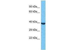 Western Blotting (WB) image for anti-Olfactory Receptor, Family 2, Subfamily S, Member 2 (OR2S2) (C-Term) antibody (ABIN2791727) (OR2S2 抗体  (C-Term))