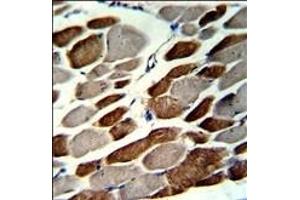 Formalin-fixed and paraffin-embedded human skeletal muscle with EMILIN1 Antibody (N-term), which was peroxidase-conjugated to the secondary antibody, followed by DAB staining. (Emilin1 抗体  (N-Term))