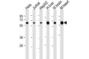 Western Blot at 1:2000 dilution Lane 1: Hela whole cell lysate Lane 2: Jurkat whole cell lysate Lane 3: HepG2 whole cell lysate Lane 4: human liver lysate Lane 5: mouse brain lysate Lane 6: mouse heart lysate Lysates/proteins at 20 ug per lane. (Phosphoglucomutase 1 抗体  (AA 251-282))
