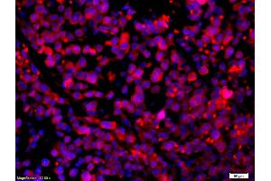 Formalin-fixed and paraffin-embedded mouse intestine carcinoma with Anti-CCR5/CD195 Polyclonal Antibody, Unconjugated (ABIN741375) 1:200, overnight at 4°C, The secondary antibody was Goat Anti-Rabbit IgG, Cy3 conjugated used at 1:200 dilution for 40 minutes at 37°C. (CCR5 抗体  (AA 201-300))