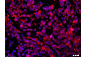Formalin-fixed and paraffin-embedded mouse intestine carcinoma with Anti-CCR5/CD195 Polyclonal Antibody, Unconjugated (ABIN741375) 1:200, overnight at 4°C, The secondary antibody was Goat Anti-Rabbit IgG, Cy3 conjugated used at 1:200 dilution for 40 minutes at 37°C. (CCR5 抗体  (AA 201-300))