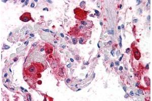 Human Lung: Formalin-Fixed, Paraffin-Embedded (FFPE) (Syntaxin 5 抗体  (AA 1-101))