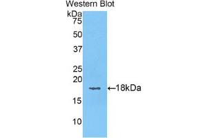 Western blot analysis of the recombinant protein. (KRT6A 抗体  (AA 323-461))