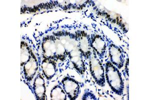 Immunohistochemistry (IHC) image for anti-Minichromosome Maintenance Complex Component 3 (MCM3) (AA 13-27), (N-Term) antibody (ABIN3044243)