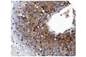 IHC analysis of GSDMD using anti-GSDMD antibody (ABIN7599432).
