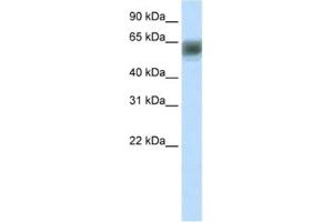 Western Blotting (WB) image for anti-AT Rich Interactive Domain 3B (BRIGHT-Like) (ARID3B) antibody (ABIN2460904) (ARID3B 抗体)