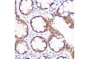 Immunohistochemistry of paraffin-embedded human colon using IGF2BP2/IGF2BP2/IMP2 Rabbit mAb (ABIN7267903) at dilution of 1:100 (40x lens). (IGF2BP2 抗体)