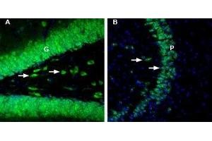 Expression of Glucose Transporter 2 in rat and mouse brain - Immunohistochemical staining of rat and mouse brain sections using Anti-GLUT2 (SLC2A2)-ATTO Fluor-488 Antibody (ABIN7043695).