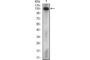 Western blot analysis using MCAM mouse mAb against Hela cell lysate. (MCAM 抗体  (AA 84-189))