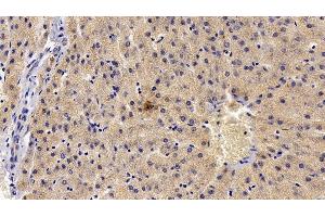 Detection of TEC in Porcine Liver Tissue using Polyclonal Antibody to Tec Protein Tyrosine Kinase (TEC) (Tec Protein Tyrosine Kinase (TEC) (AA 370-623) 抗体)