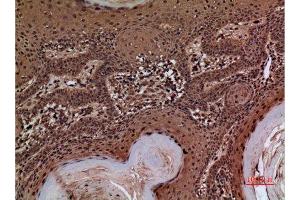 Immunohistochemistry (IHC) analysis of paraffin-embedded Human Skin, antibody was diluted at 1:100.