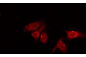 ABIN6267468 staining NIH-3T3 by IF/ICC. (CDC25B 抗体  (pSer353))