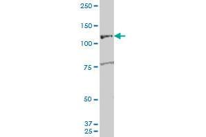 ARHGEF1 polyclonal antibody (A01), Lot # 060726QCS1 Western Blot analysis of ARHGEF1 expression in K-562 . (ARHGEF1 抗体  (AA 830-927))