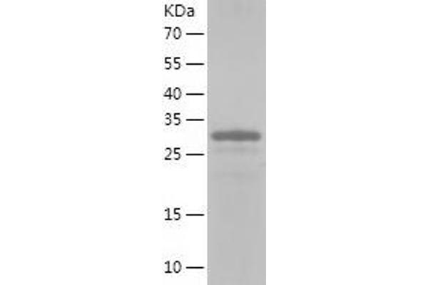 Vinexin Protein (AA 1-329) (His tag)