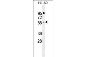 Western blot analysis in HL-60 cell line lysates (35ug/lane). (FBXW11 抗体  (AA 168-196))