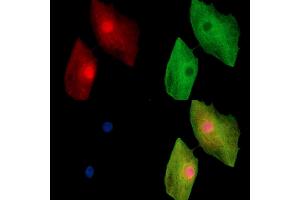 ABIN7096066 and ABIN7100128 staining  cells by IF/ICC.