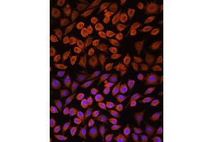 Immunofluorescence analysis of L929 cells using PDP1 Rabbit pAb (ABIN7269774) at dilution of 1:100. (PDP 抗体  (AA 72-260))