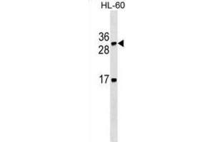 Western Blotting (WB) image for anti-Lymphotoxin beta (TNF Superfamily, Member 3) (LTB) antibody (ABIN2995416) (LTB 抗体)