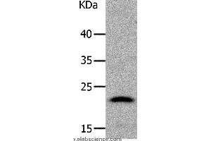 Western blot analysis of Human liver cancer tissue, using LCN2 Polyclonal Antibody at dilution of 1:1050 (Lipocalin 2 抗体)