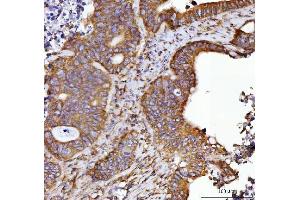 IHC analysis of Septin 2/SEPTIN2 using anti-Septin 2/SEPTIN2 antibody (ABIN7599275). (Septin 2 抗体  (AA 1-326))
