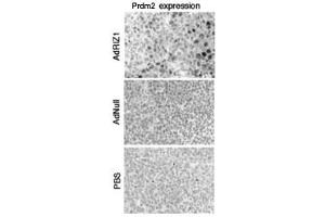 Immunocytochemical analysis of Prdm2 in adenovirus-transduced tumor cells. (PRDM2 抗体  (AA 245-573))