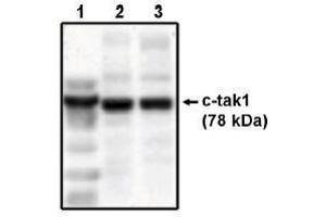 Image no. 1 for anti-MAP/microtubule Affinity-Regulating Kinase 3 (MARK3) antibody (ABIN264979) (MARK3 抗体)