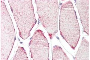 Human Skeletal Muscle: Formalin-Fixed, Paraffin-Embedded (FFPE) (TRIM54 抗体  (AA 388-400))