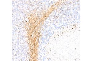 Immunohistochemistry (IHC) image for anti-Neurofilament, Heavy Polypeptide (NEFH) (AA 1040-1090) antibody (ABIN7453896)