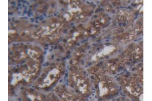 IHC-P analysis of Pig Kidney Tissue, with DAB staining. (FTH1 抗体  (AA 1-181))