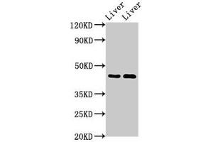 Western Blot Positive WB detected in: Rat liver tissue, Mouse liver tissue All lanes: SERPINA5 antibody at 3 μg/mL Secondary Goat polyclonal to rabbit IgG at 1/50000 dilution Predicted band size: 46 kDa Observed band size: 46 kDa