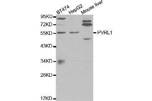 Western Blotting (WB) image for anti-Poliovirus Receptor-Related 1 (Herpesvirus Entry Mediator C) (PVRL1) (AA 70-350) antibody (ABIN3022757)