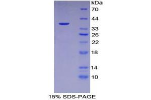 SDS-PAGE analysis of Human Keratin 15 Protein. (KRT15 蛋白)
