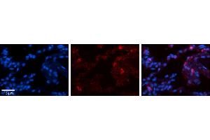 Rabbit Anti-GPX3 Antibody     Formalin Fixed Paraffin Embedded Tissue: Human Lung Tissue  Observed Staining: Membrane and cytoplasmic in alveolar type I & II cells  Primary Antibody Concentration: 1:100  Other Working Concentrations: 1/600  Secondary Antibody: Donkey anti-Rabbit-Cy3  Secondary Antibody Concentration: 1:200  Magnification: 20X  Exposure Time: 0. (GPX3 抗体  (N-Term))